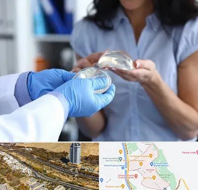 پروتز باسن در خیابان نیایش شیراز