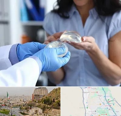 پروتز باسن در فرهنگ شهر شیراز