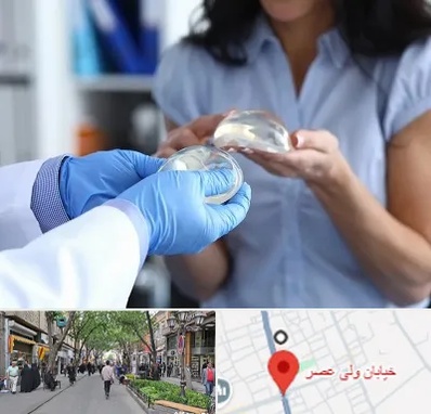 پروتز باسن در ولیعصر شهریار