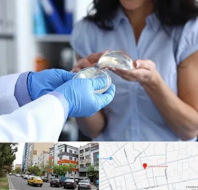 پروتز باسن در هفده شهریور تبریز