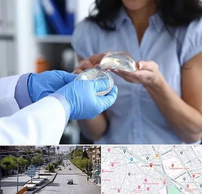 پروتز باسن در خیابان زند شیراز