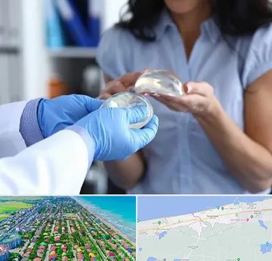 پروتز باسن در فریدونکنار