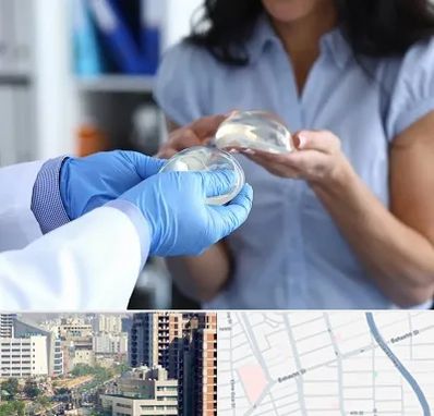 پروتز باسن در خیابان بهشتی