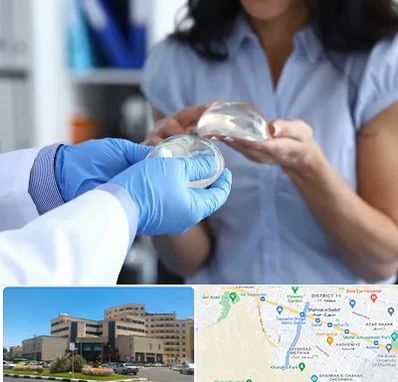 پروتز باسن در صیاد شیرازی مشهد