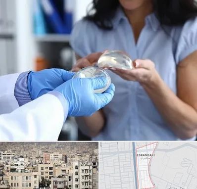 پروتز باسن در اسکندری