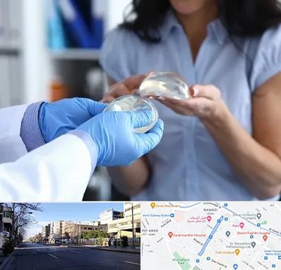 پروتز باسن در خیابان ملاصدرا شیراز