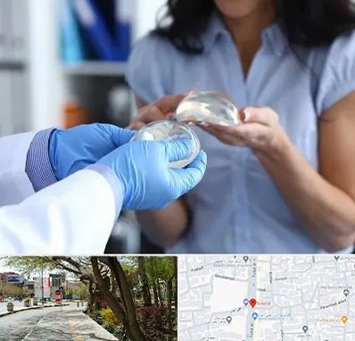 پروتز باسن در خیابان توحید اصفهان