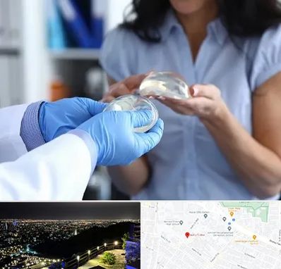 پروتز باسن در هفت تیر مشهد