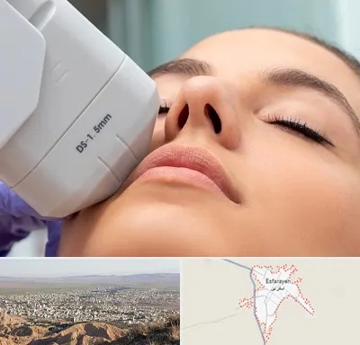 هایفوتراپی در اسفراین