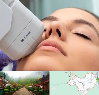 هایفوتراپی در فومن