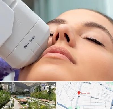 هایفوتراپی در بلوار تعاون