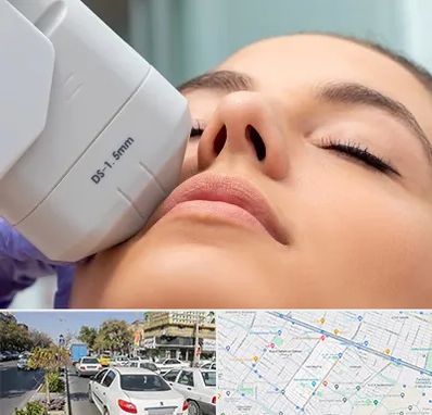 هایفوتراپی در مفتح مشهد