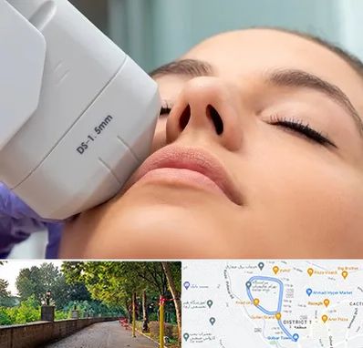 هایفوتراپی در بلوار گیلان رشت