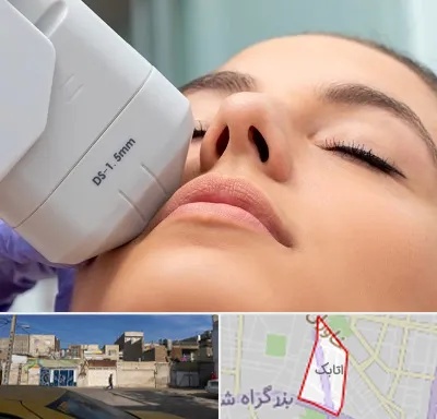 هایفوتراپی در اتابک