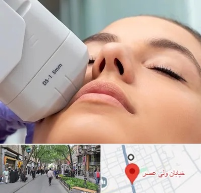 هایفوتراپی در ولیعصر شهریار