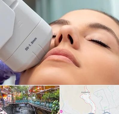 هایفوتراپی در درکه