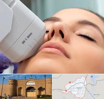 هایفوتراپی در ایرانشهر