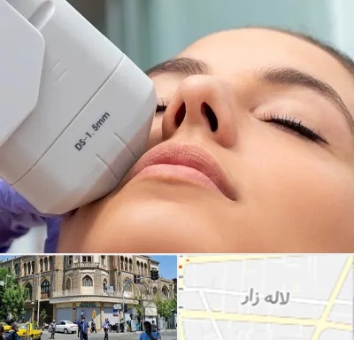 هایفوتراپی در لاله زار