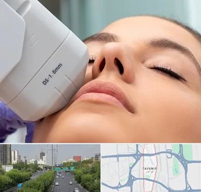 هایفوتراپی در توانیر