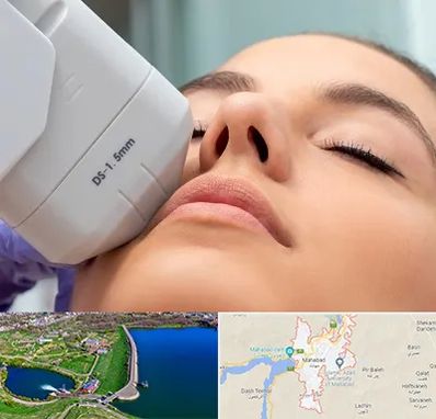 هایفوتراپی در مهاباد