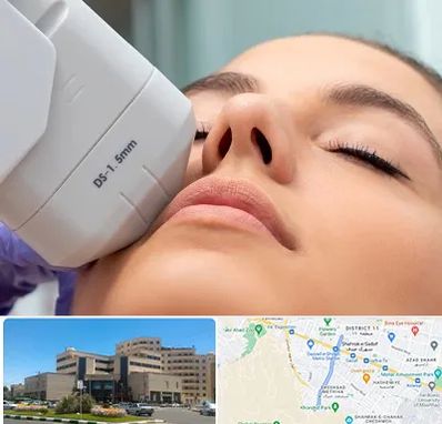 هایفوتراپی در صیاد شیرازی مشهد