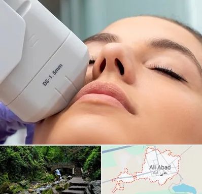 هایفوتراپی در علی آباد کتول