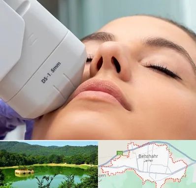هایفوتراپی در بهشهر