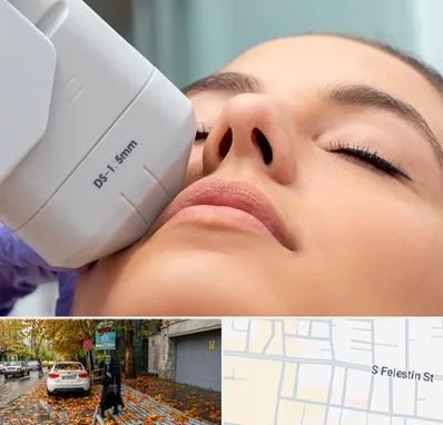 هایفوتراپی در خیابان فلسطین