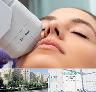 هایفوتراپی در آپادانا