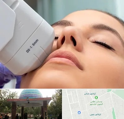 هایفوتراپی در کیانشهر