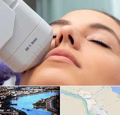 هایفوتراپی در خرمشهر