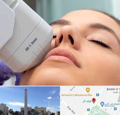 هایفوتراپی در فلکه گاز شیراز