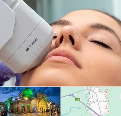 هایفوتراپی در آستانه اشرفیه