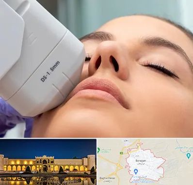 هایفوتراپی در برازجان