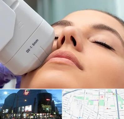 هایفوتراپی در بلوار اباذر