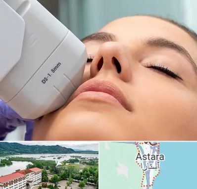 هایفوتراپی در آستارا
