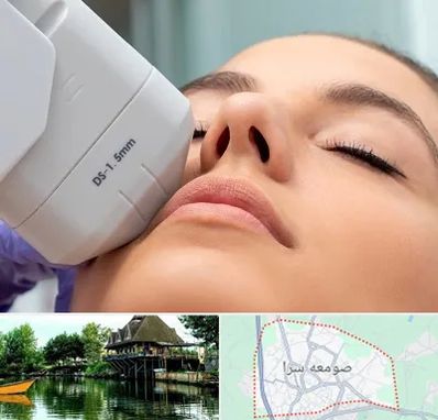 هایفوتراپی در صومعه سرا