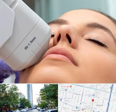 هایفوتراپی در امامت مشهد