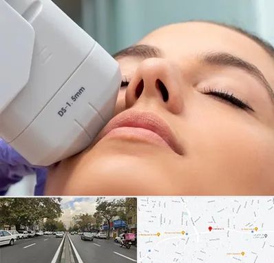 هایفوتراپی در دولت