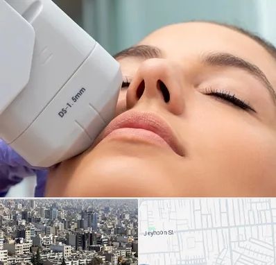 هایفوتراپی در جیحون