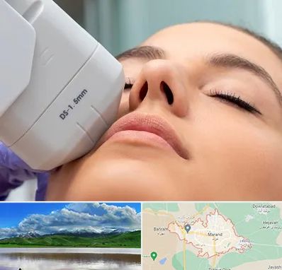 هایفوتراپی در مرند