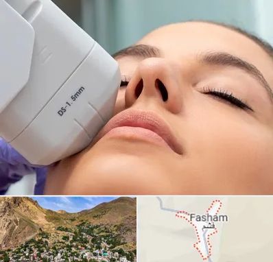 هایفوتراپی در فشم