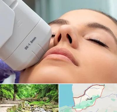 هایفوتراپی در گلستان
