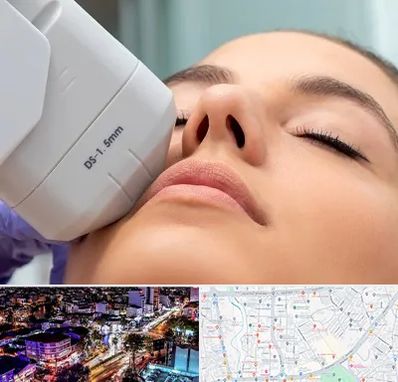 هایفوتراپی در منظریه رشت