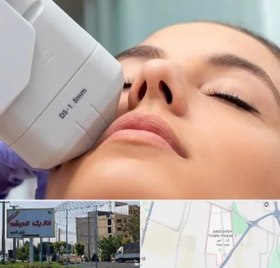 هایفوتراپی در فاز یک اندیشه