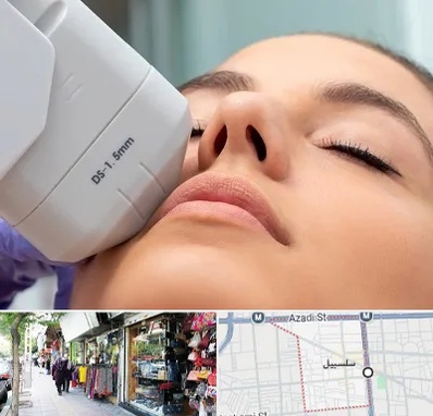 هایفوتراپی در سلسبیل