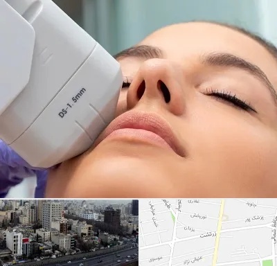 هایفوتراپی در زرتشت