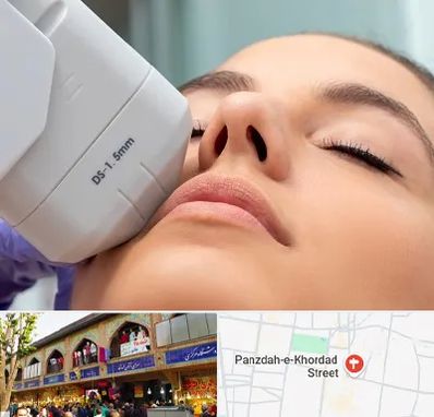 هایفوتراپی در 15 خرداد