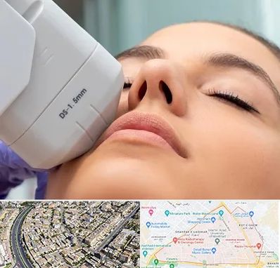 هایفوتراپی در شهرک غرب مشهد