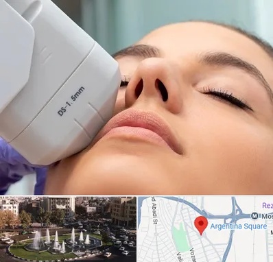 هایفوتراپی در آرژانتین